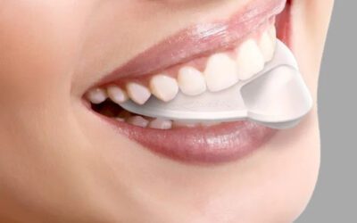 Spoony Gloss : une solution française innovante pour rééduquer la langue et rétablir l’équilibre corporel